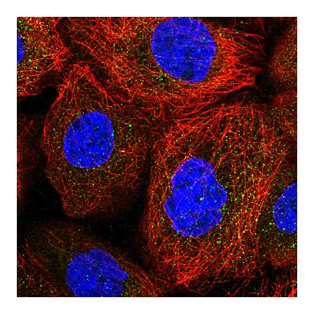 Atlas Antibodies Anti-ACOXL Antibody