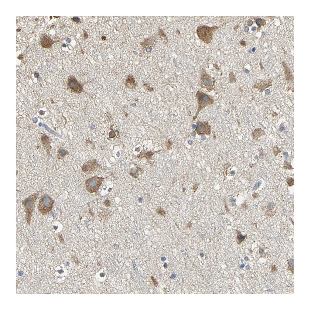 Atlas Antibodies Anti-ACSL4 Antibody