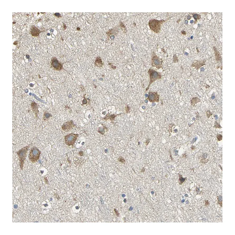 Atlas Antibodies Anti-ACSL4 Antibody