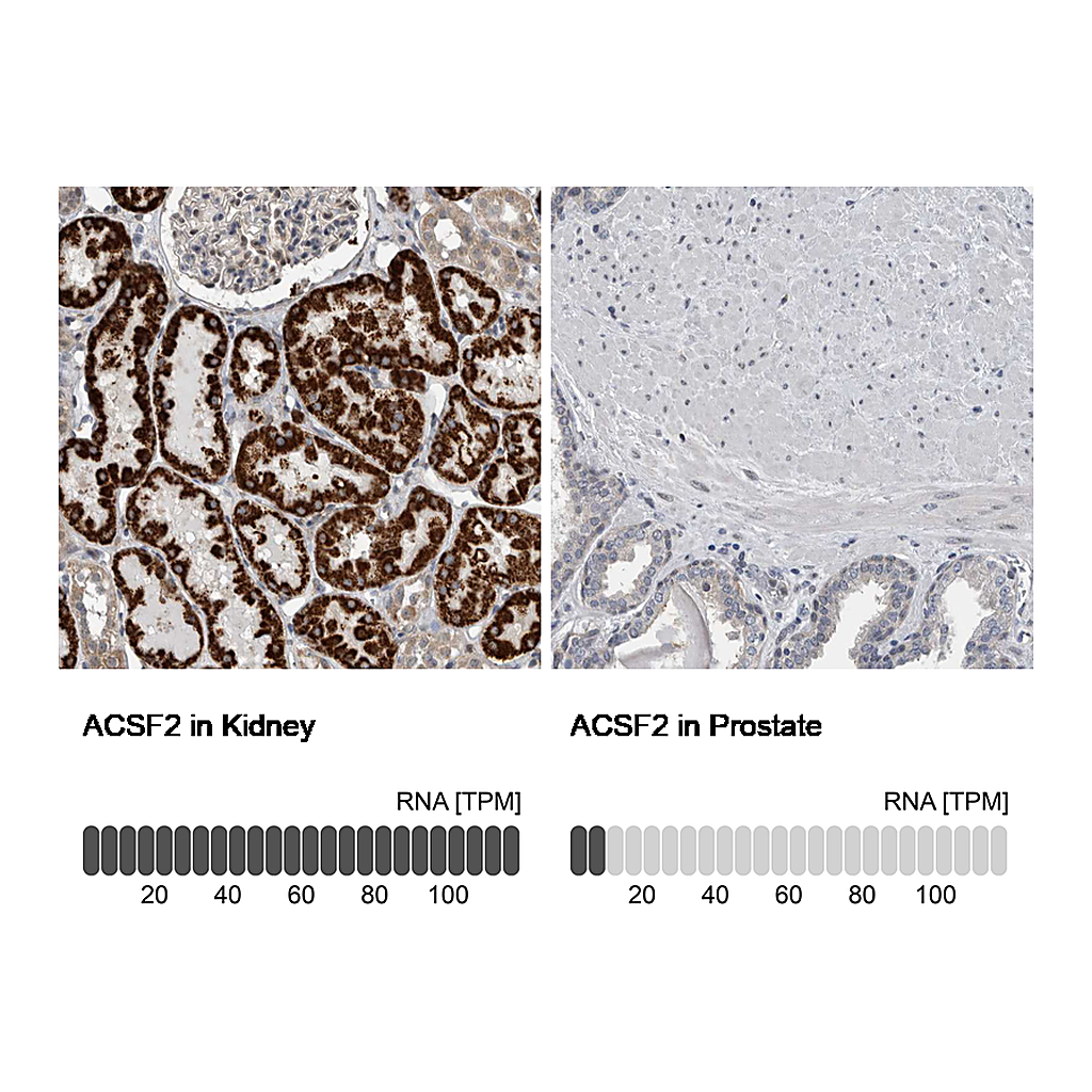 Atlas Antibodies Anti-ACSF2 Antibody