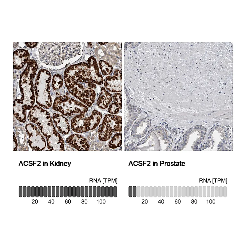 Atlas Antibodies Anti-ACSF2 Antibody
