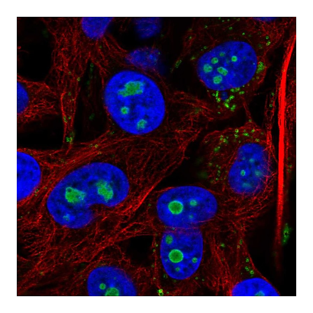 Atlas Antibodies Anti-ACSL3 Antibody