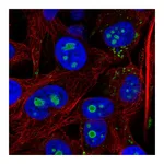 Atlas Antibodies Anti-ACSL3 Antibody