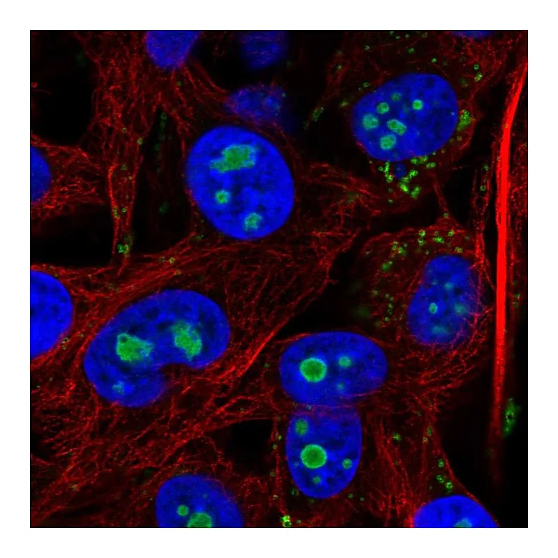 Atlas Antibodies Anti-ACSL3 Antibody
