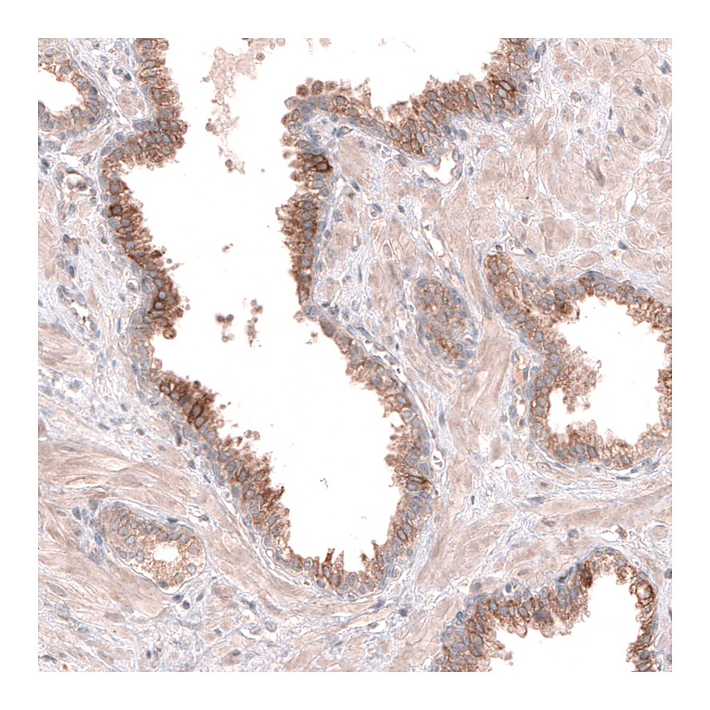 Atlas Antibodies Anti-ACSL3 Antibody