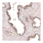 Atlas Antibodies Anti-ACSL3 Antibody