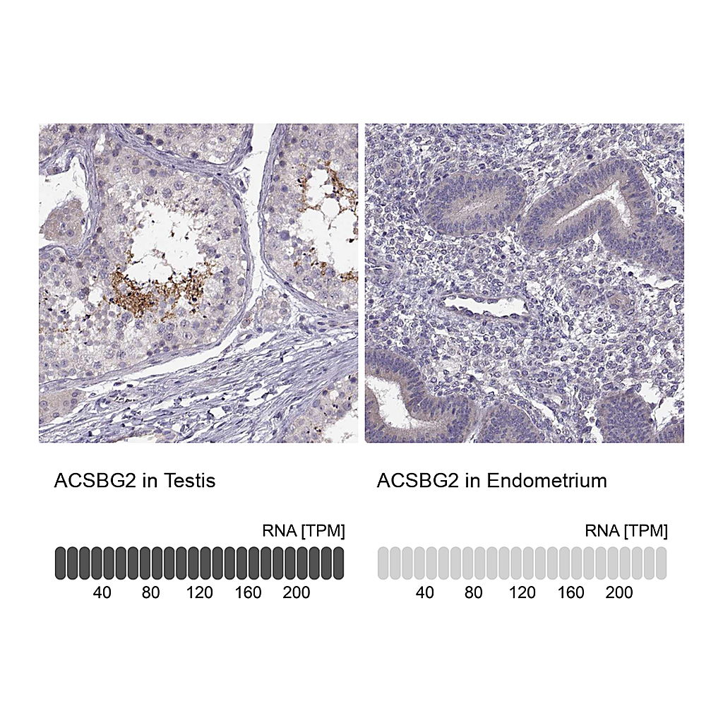 Atlas Antibodies Anti-ACSBG2 Antibody