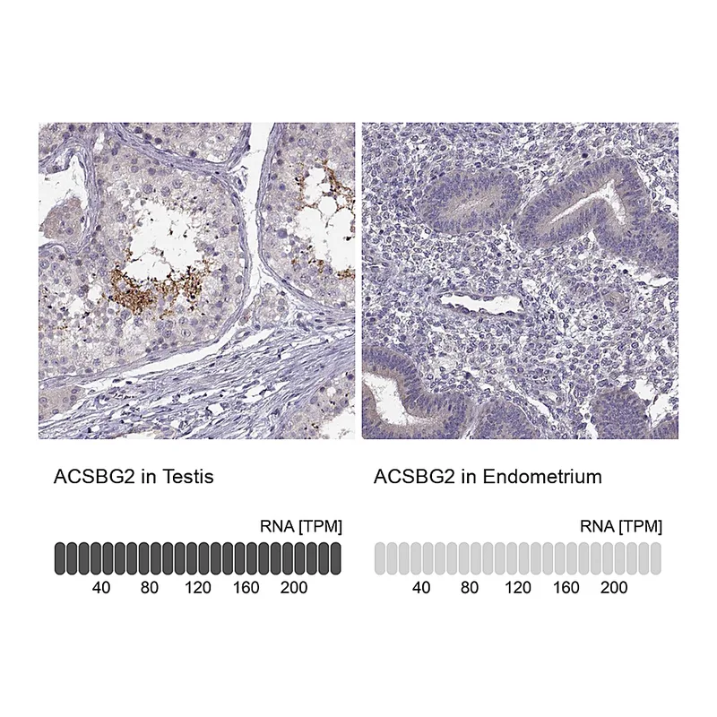 Atlas Antibodies Anti-ACSBG2 Antibody