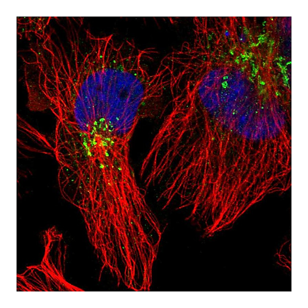 Atlas Antibodies Anti-ACSL4 Antibody