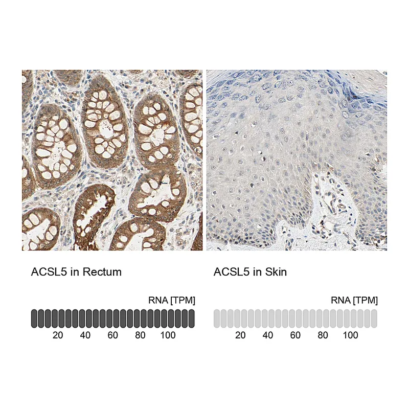 Atlas Antibodies Anti-ACSL5 Antibody