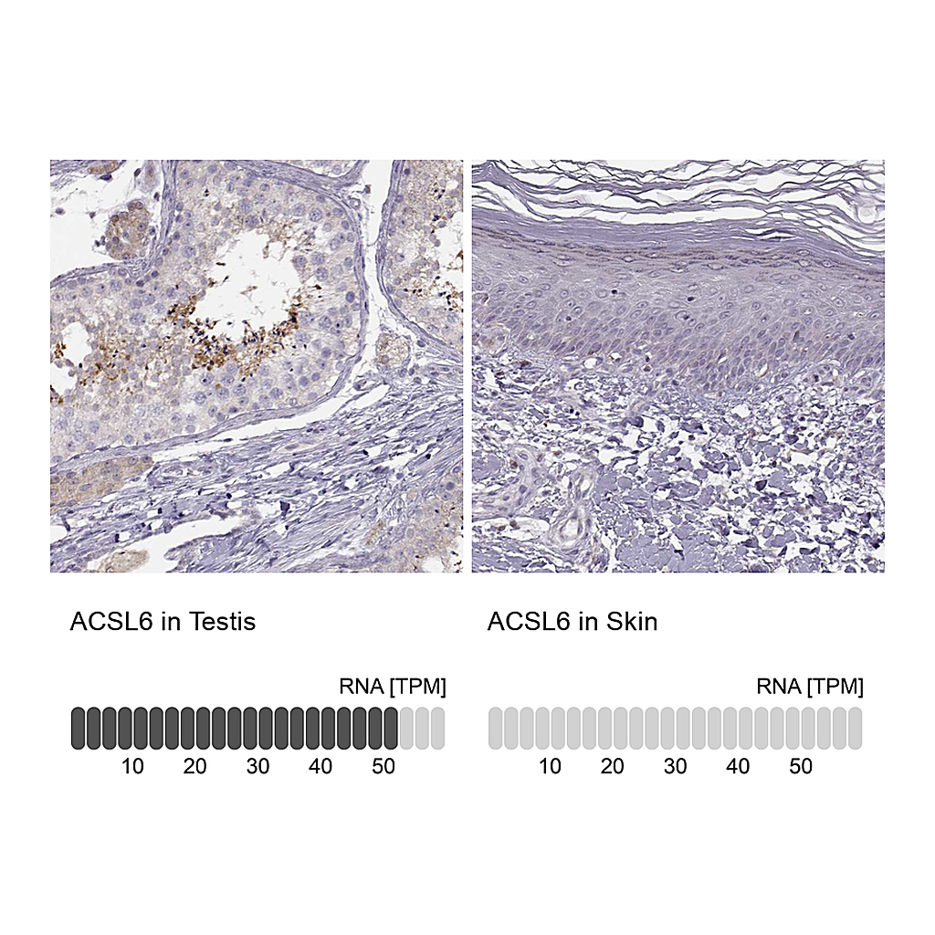 Atlas Antibodies Anti-ACSL6 Antibody