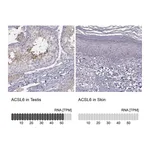 Atlas Antibodies Anti-ACSL6 Antibody
