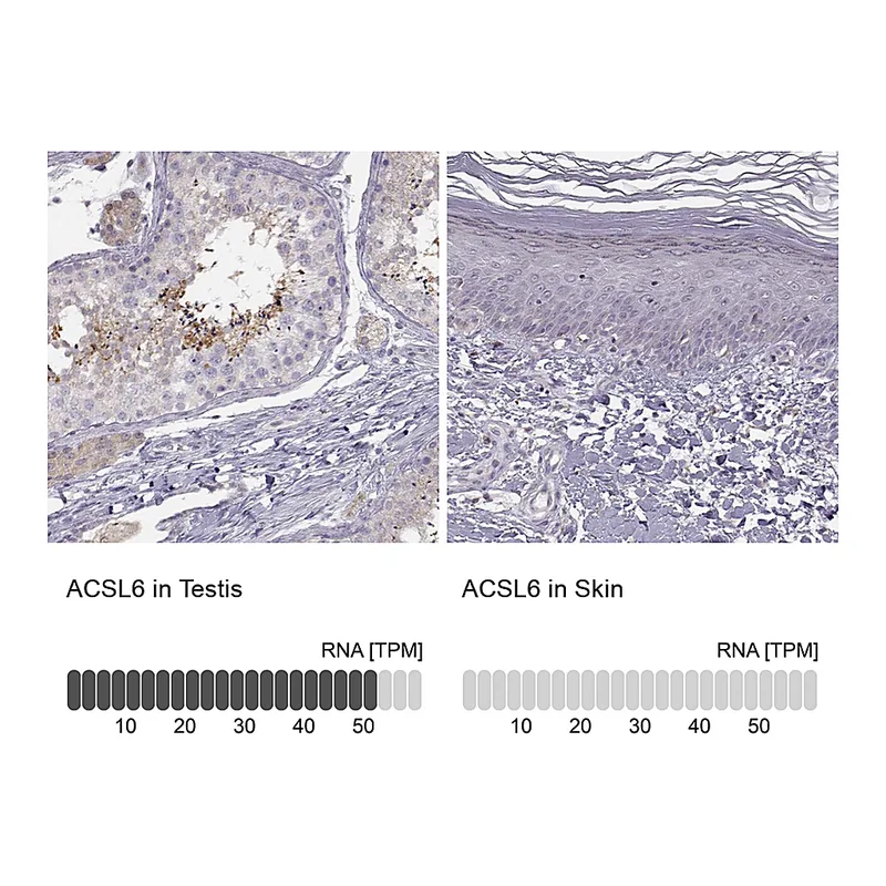Atlas Antibodies Anti-ACSL6 Antibody