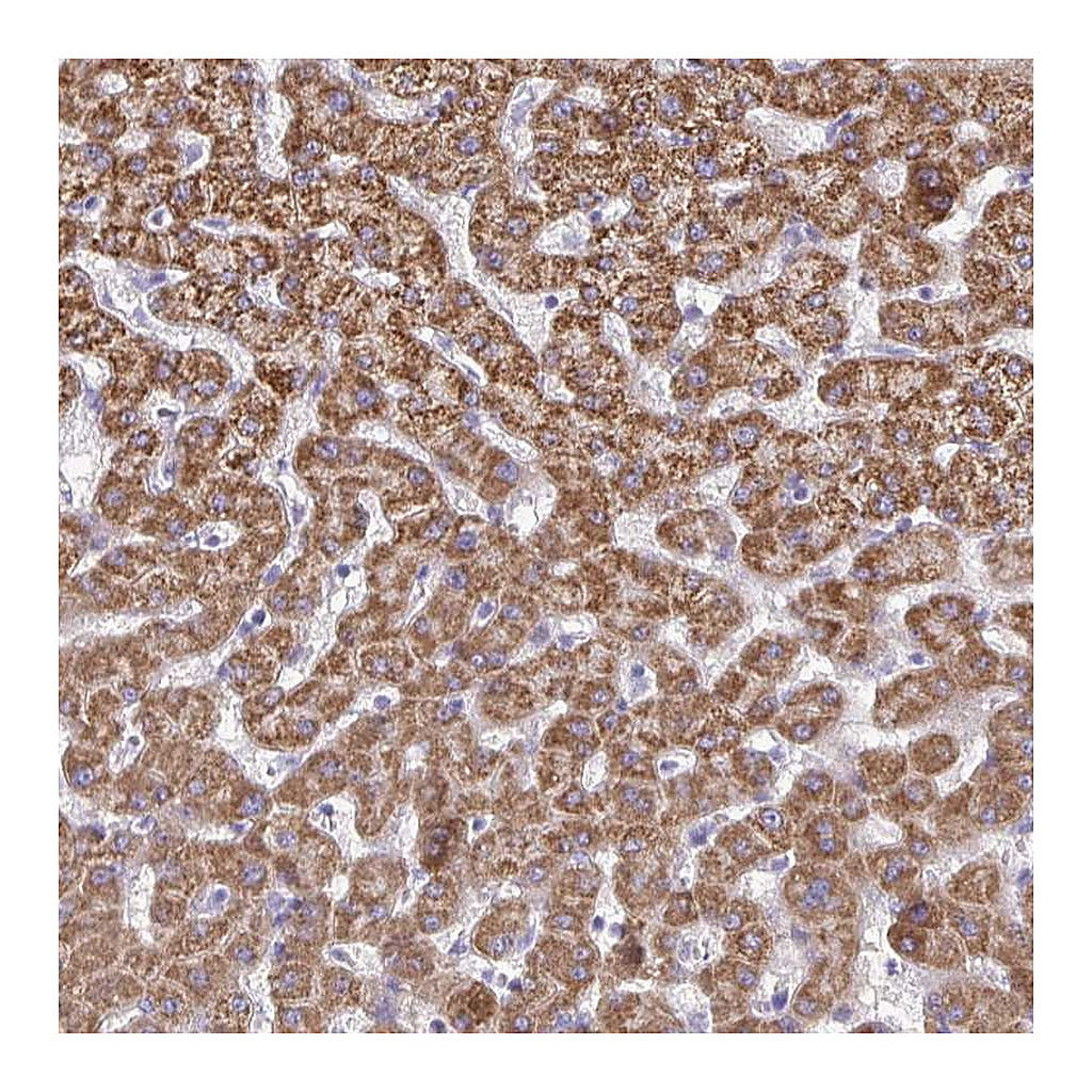 Atlas Antibodies Anti-ACSM2A Antibody