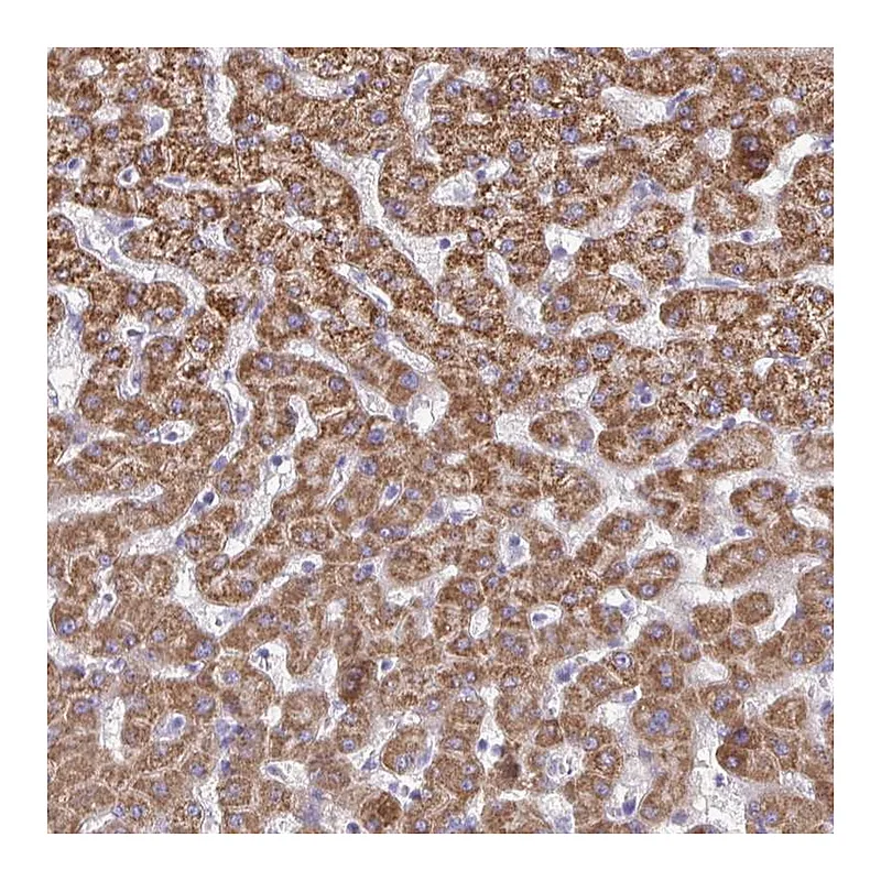 Atlas Antibodies Anti-ACSM2A Antibody