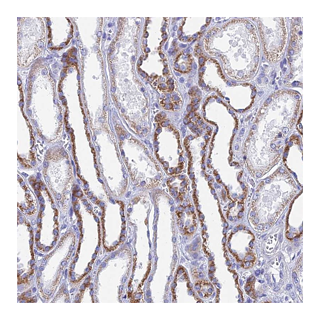 Atlas Antibodies Anti-ACSM1 Antibody