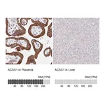 Atlas Antibodies Anti-ACSS1 Antibody