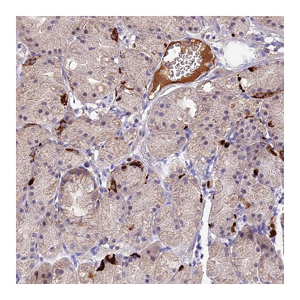 Atlas Antibodies Anti-ACSM6 Antibody
