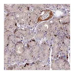Atlas Antibodies Anti-ACSM6 Antibody