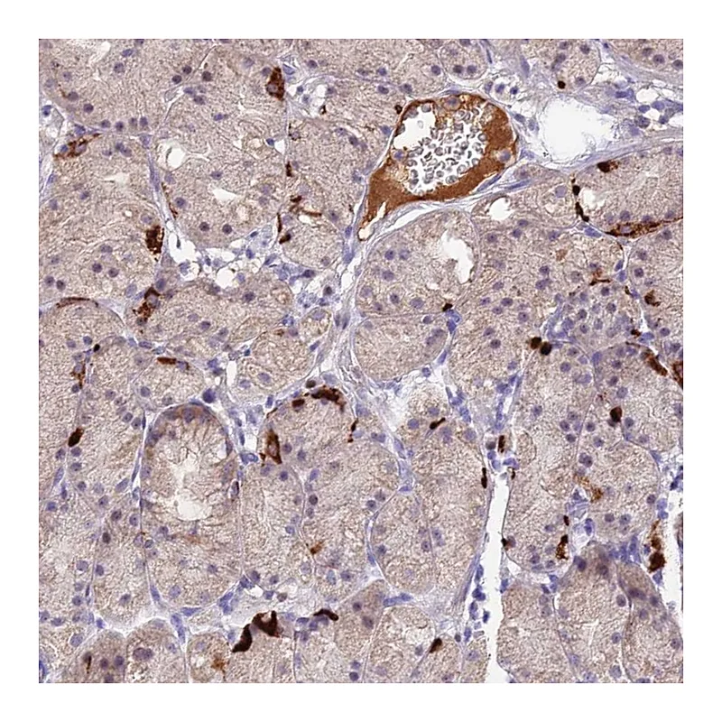Atlas Antibodies Anti-ACSM6 Antibody