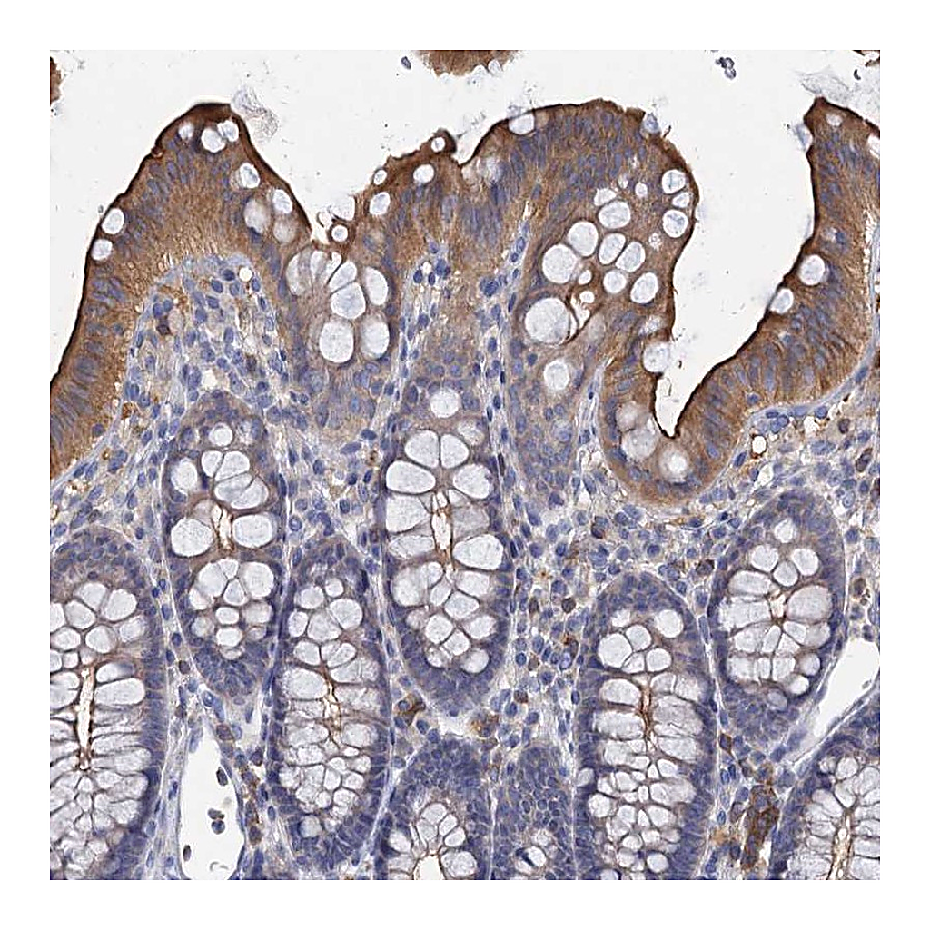 Atlas Antibodies Anti-ACSM3 Antibody