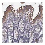 Atlas Antibodies Anti-ACSM3 Antibody