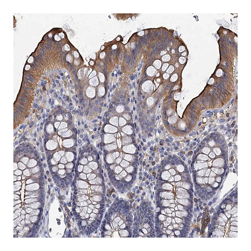 Atlas Antibodies Anti-ACSM3 Antibody