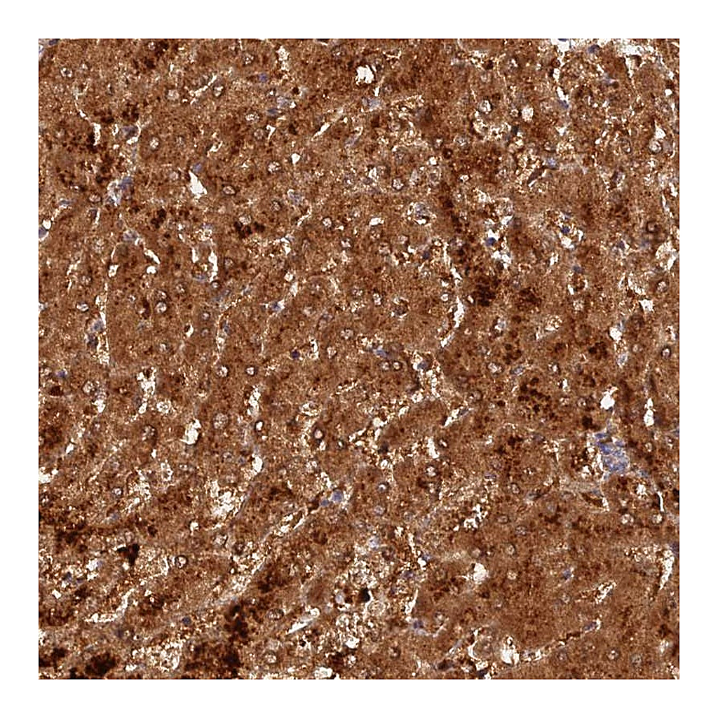 Atlas Antibodies Anti-ACSM5 Antibody