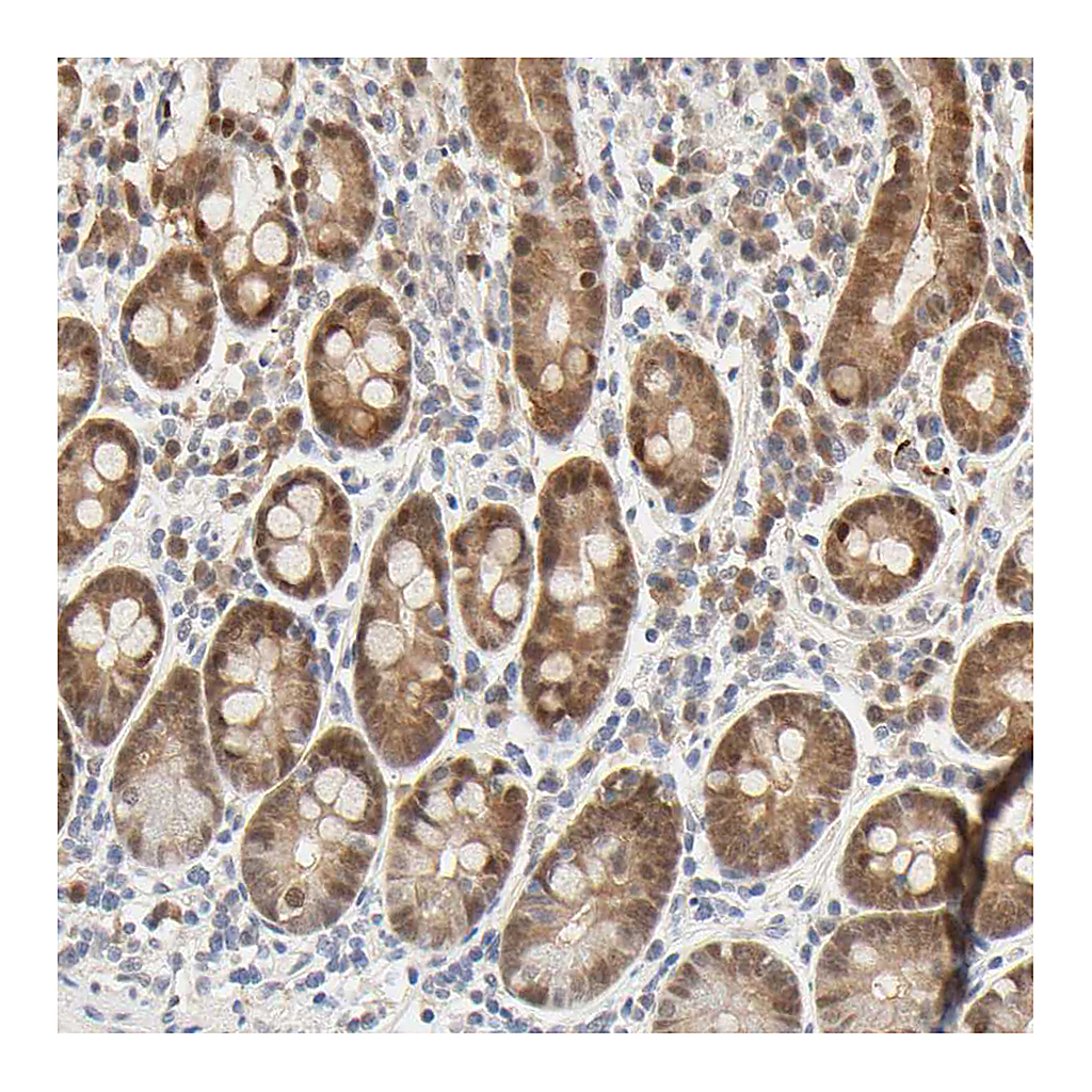 Atlas Antibodies Anti-ACSS2 Antibody
