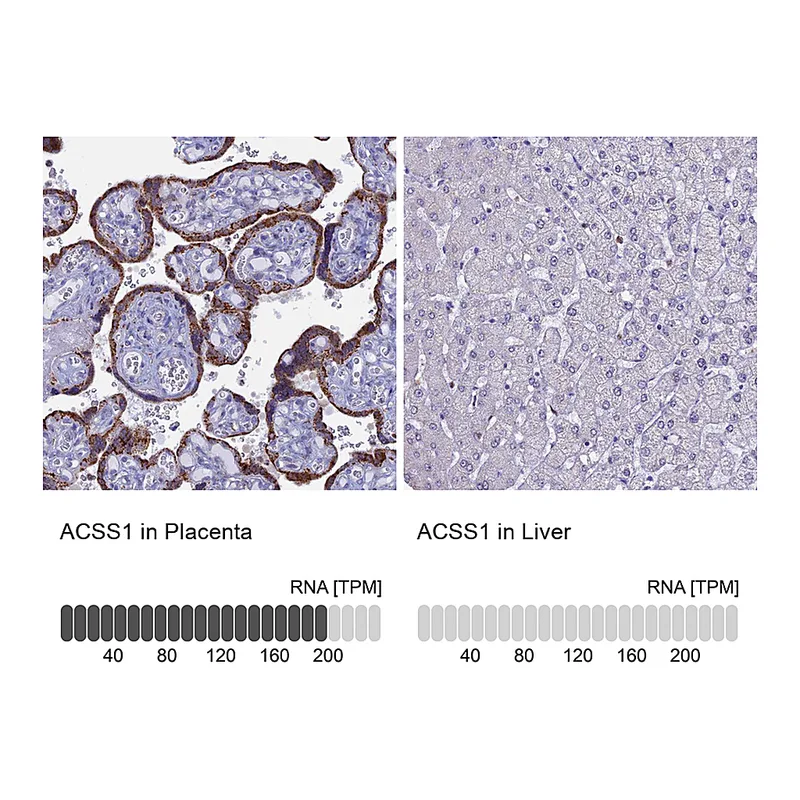 Atlas Antibodies Anti-ACSS1 Antibody