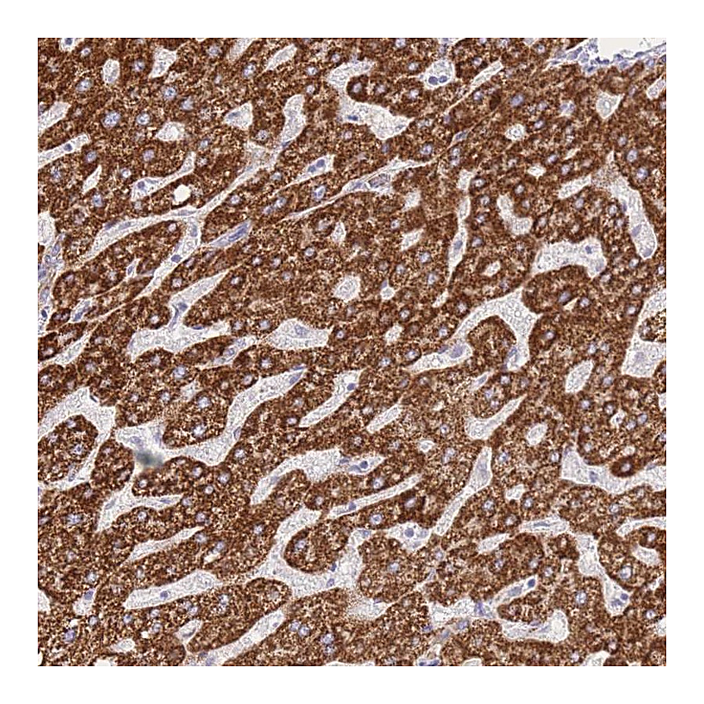 Atlas Antibodies Anti-ACSM4 Antibody