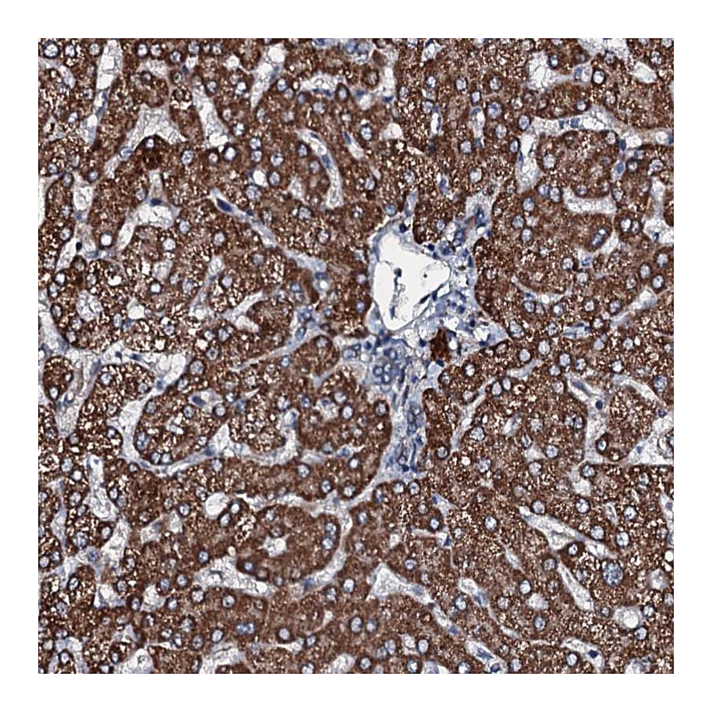 Atlas Antibodies Anti-ACSS3 Antibody