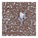 Atlas Antibodies Anti-ACSS3 Antibody