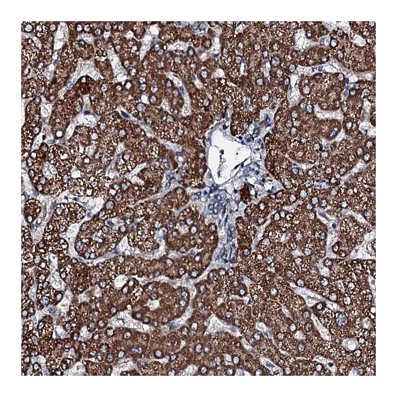 Atlas Antibodies Anti-ACSS3 Antibody