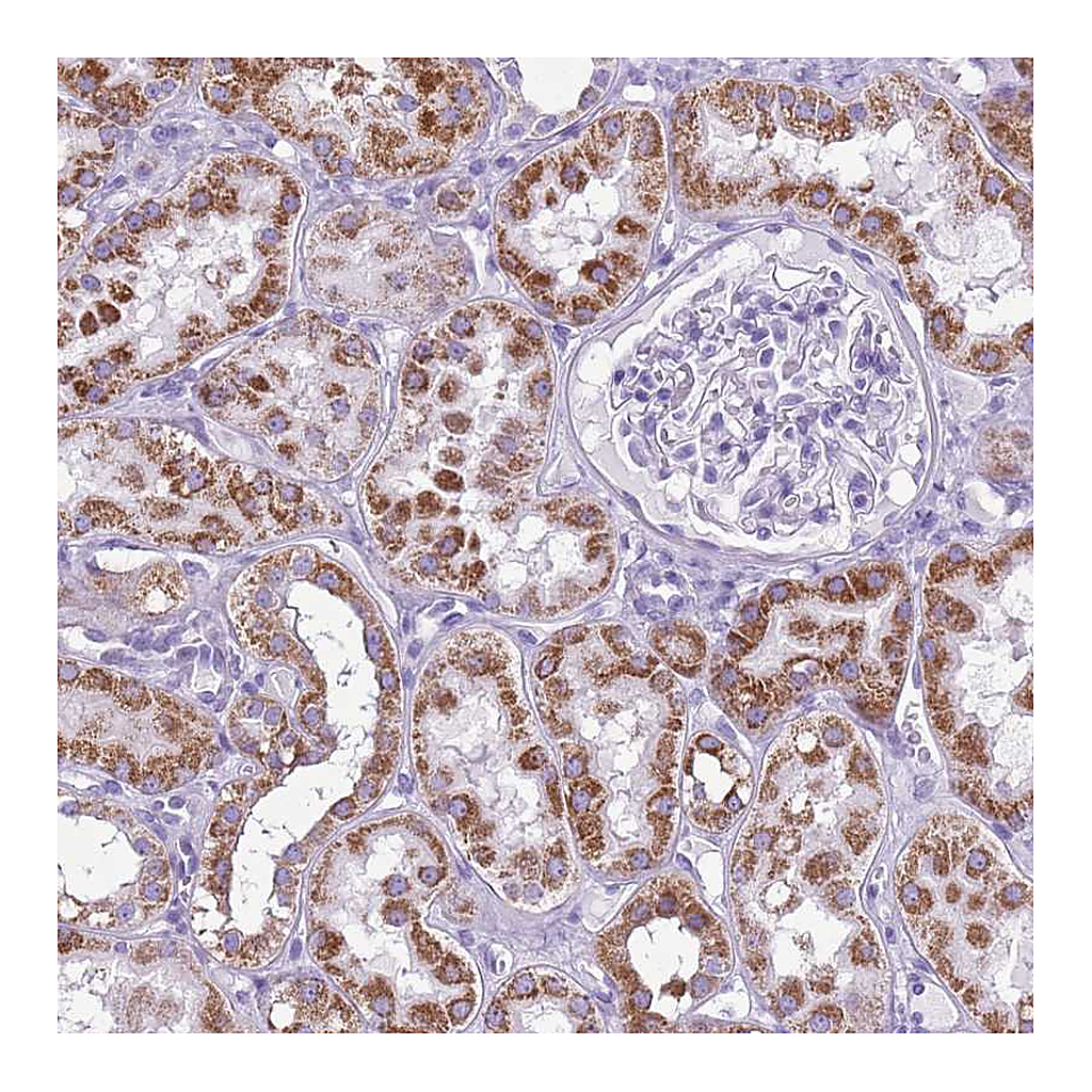 Atlas Antibodies Anti-ACSS3 Antibody