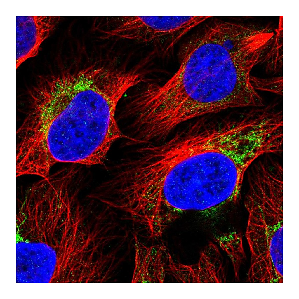Atlas Antibodies Anti-ACSS3 Antibody
