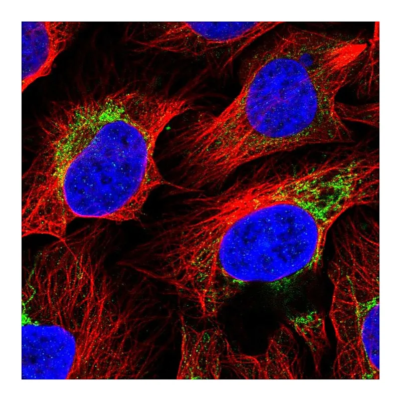Atlas Antibodies Anti-ACSS3 Antibody