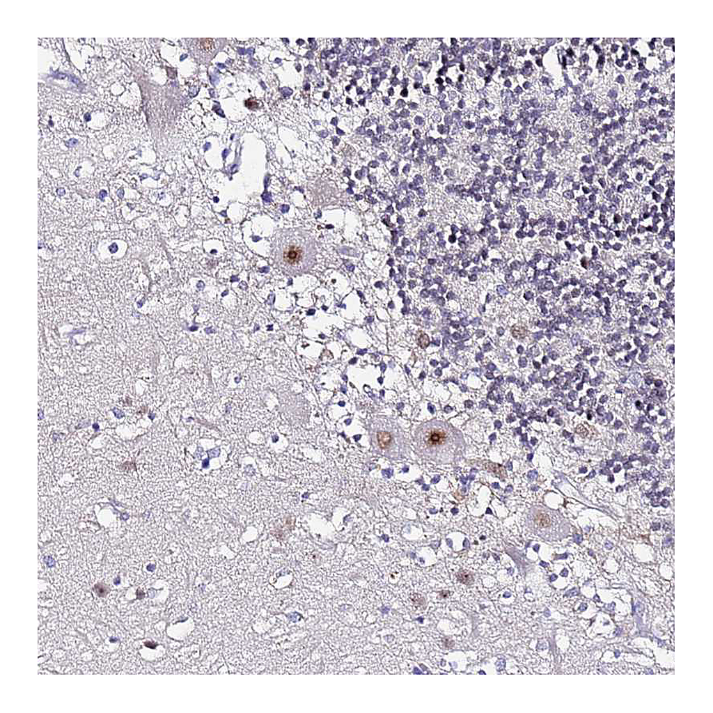 Atlas Antibodies Anti-ACTL6B Antibody