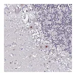 Atlas Antibodies Anti-ACTL6B Antibody