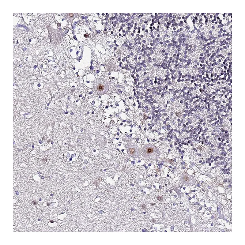 Atlas Antibodies Anti-ACTL6B Antibody