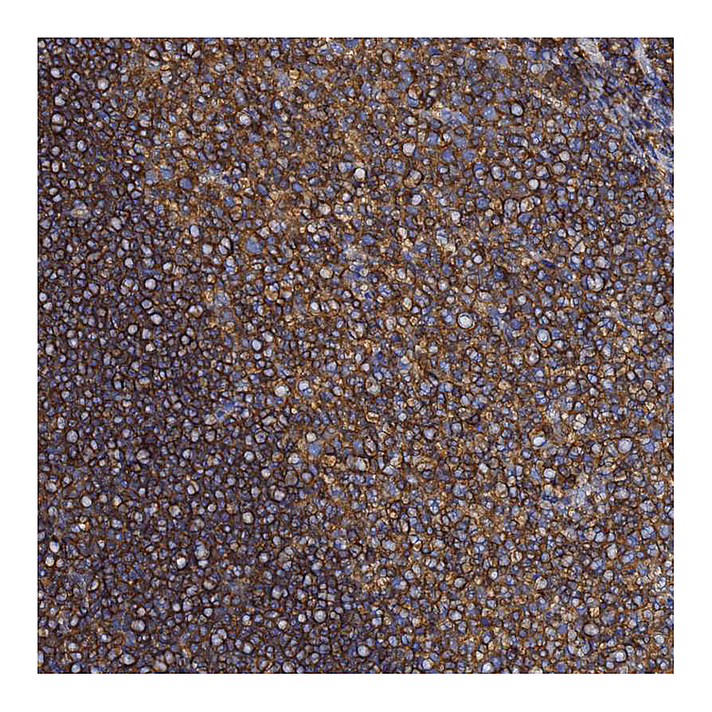 Atlas Antibodies Anti-ACTB Antibody