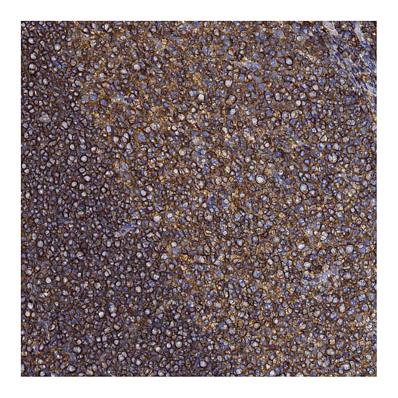 Atlas Antibodies Anti-ACTB Antibody