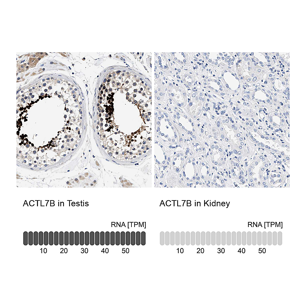 Atlas Antibodies Anti-ACTL7B Antibody