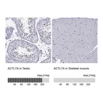 Atlas Antibodies Anti-ACTL7A Antibody