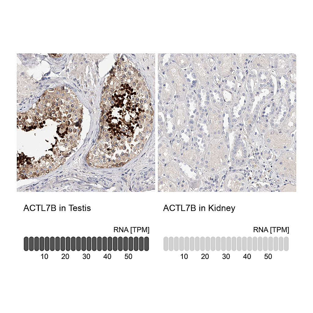Atlas Antibodies Anti-ACTL7B Antibody