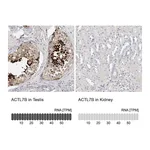 Atlas Antibodies Anti-ACTL7B Antibody