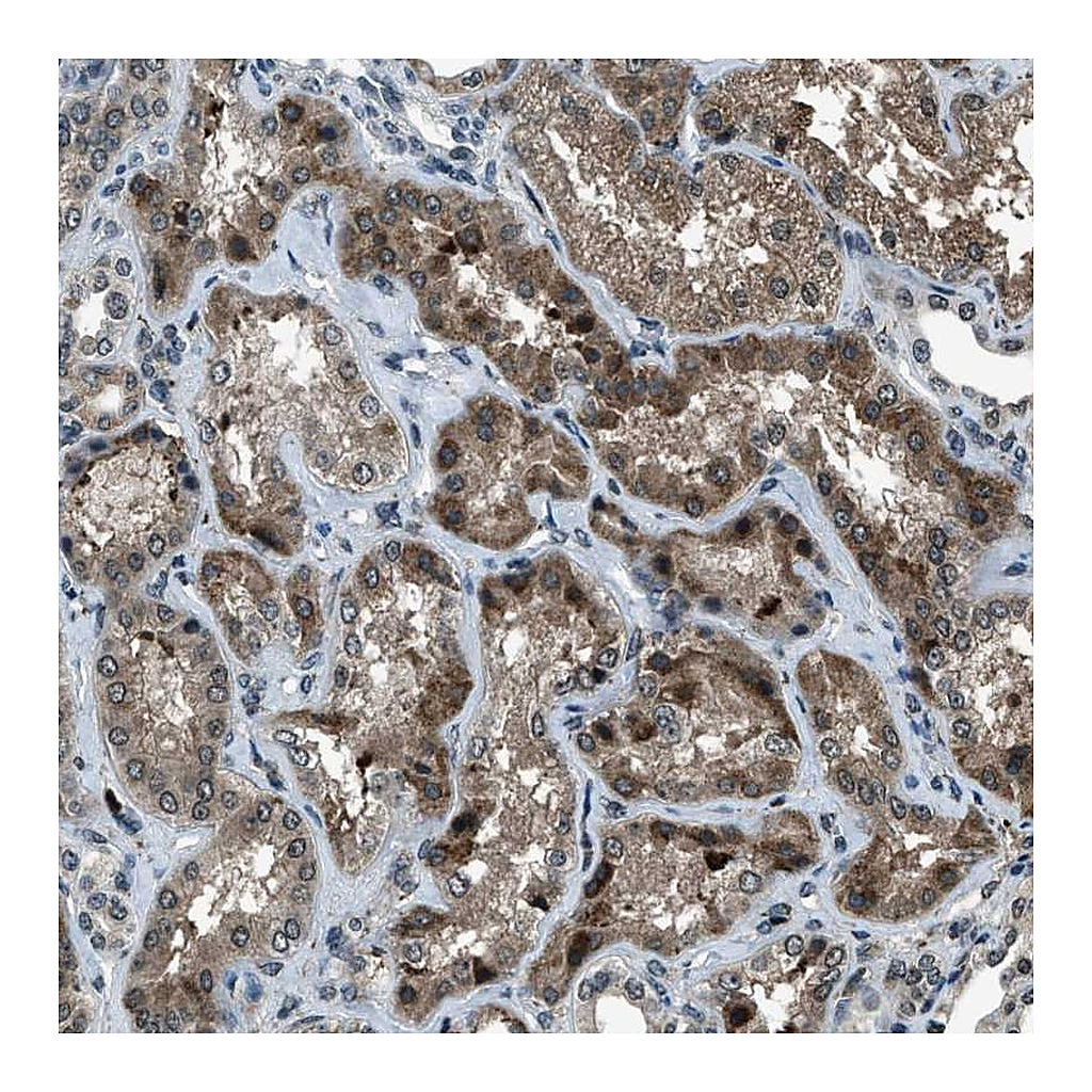 Atlas Antibodies Anti-ACTL9 Antibody