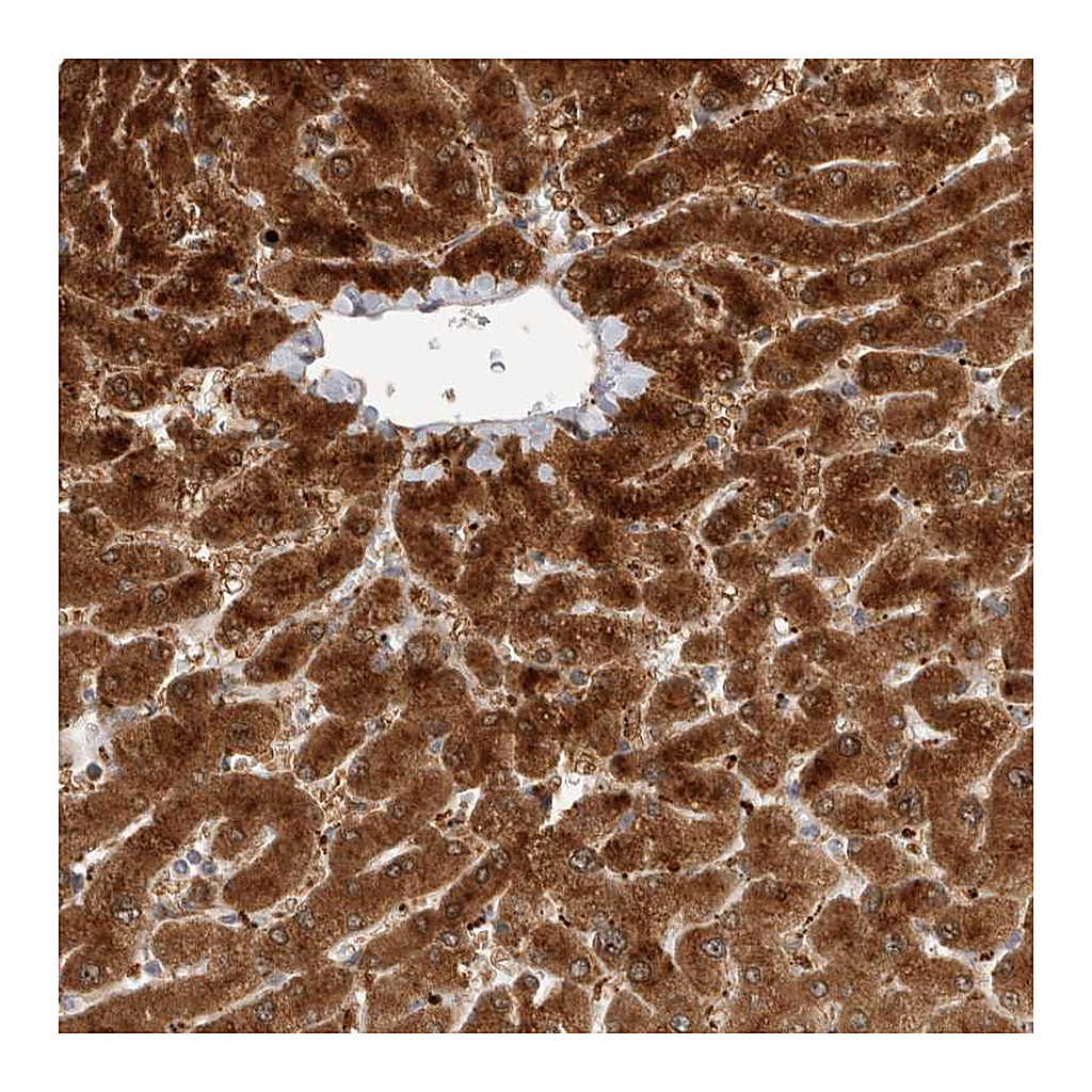 Atlas Antibodies Anti-ACTL9 Antibody