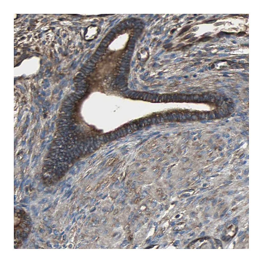 Atlas Antibodies Anti-ACTN1 Antibody