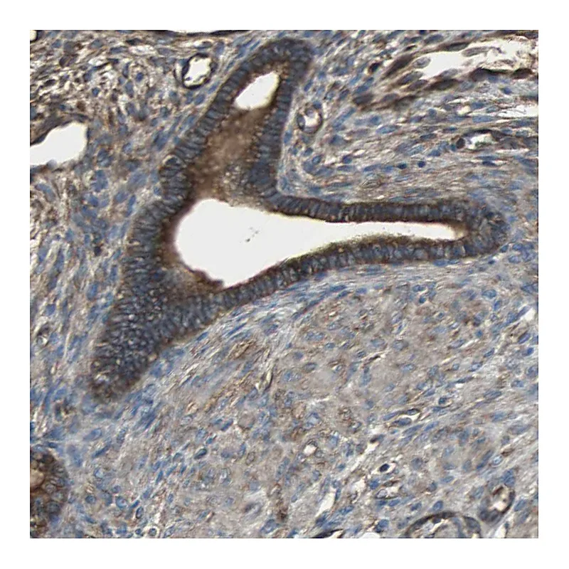 Atlas Antibodies Anti-ACTN1 Antibody